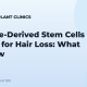Adipose-Derived Stem Cells (ADSC) for Hair Loss: What to Know