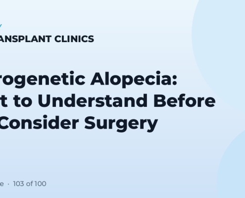 Androgenetic Alopecia: What to Understand Before You Consider Surgery