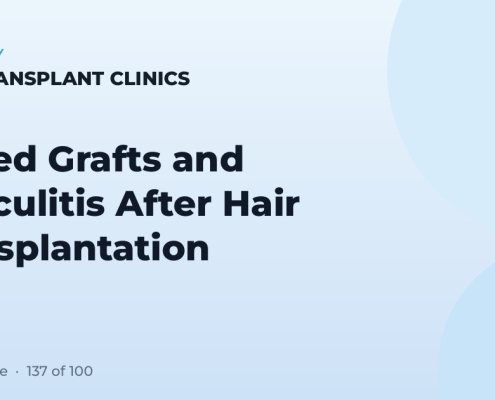Buried Grafts and Folliculitis After Hair Transplantation