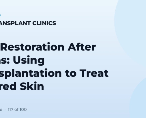 Hair Restoration After Burns: Using Transplantation to Treat Scarred Skin