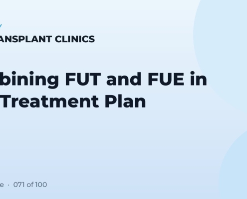Combining FUT and FUE in One Treatment Plan