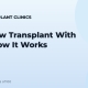 Eyebrow Transplant With FUE: How It Works