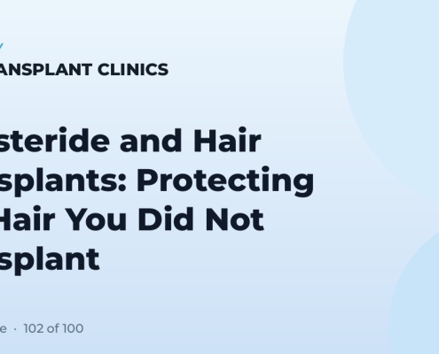Finasteride and Hair Transplants: Protecting the Hair You Did Not Transplant