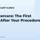 FUE Aftercare: The First Weeks After Your Procedure