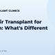 FUE Hair Transplant for Women: What's Different