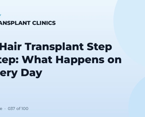 FUE Hair Transplant Step by Step: What Happens on Surgery Day