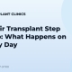 FUE Hair Transplant Step by Step: What Happens on Surgery Day