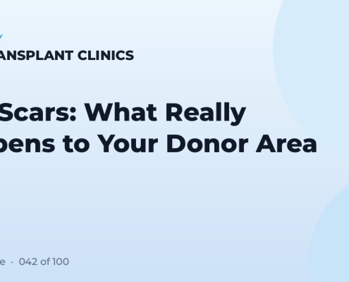 FUE Scars: What Really Happens to Your Donor Area