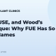 FOX, FUSE, and Wood’s Technique: Why FUE Has So Many Names