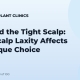 FUE and the Tight Scalp: Why Scalp Laxity Affects Technique Choice