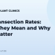 FUE Transection Rates: What They Mean and Why They Matter