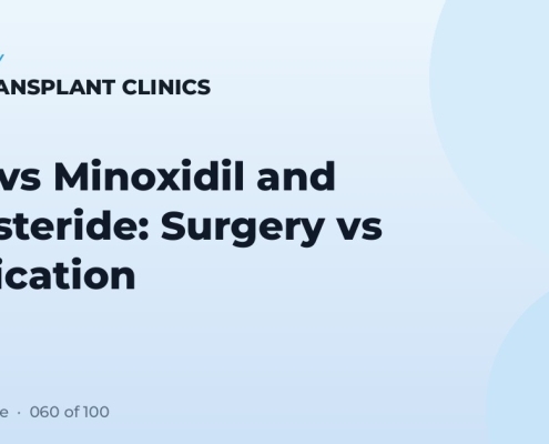 FUE vs Minoxidil and Finasteride: Surgery vs Medication