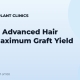 FUT for Advanced Hair Loss: Maximum Graft Yield