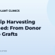 FUT Strip Harvesting Explained: From Donor Strip to Grafts