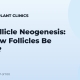 Hair Follicle Neogenesis: Can New Follicles Be Grown?