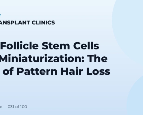 Hair Follicle Stem Cells and Miniaturization: The Core of Pattern Hair Loss
