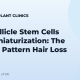 Hair Follicle Stem Cells and Miniaturization: The Core of Pattern Hair Loss