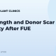 Hair Length and Donor Scar Visibility After FUE