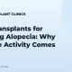 Hair Transplants for Scarring Alopecia: Why Disease Activity Comes First