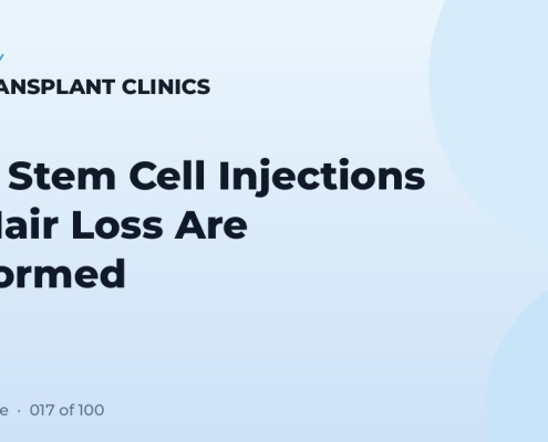 How Stem Cell Injections for Hair Loss Are Performed