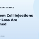 How Stem Cell Injections for Hair Loss Are Performed