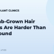 Why Lab-Grown Hair Follicles Are Harder Than They Sound