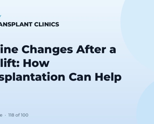 Hairline Changes After a Facelift: How Transplantation Can Help