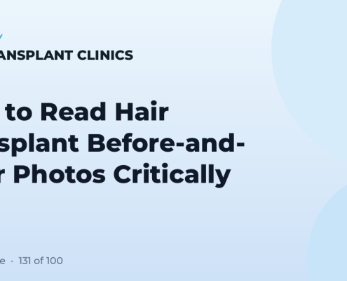 How to Read Hair Transplant Before-and-After Photos Critically
