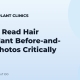 How to Read Hair Transplant Before-and-After Photos Critically