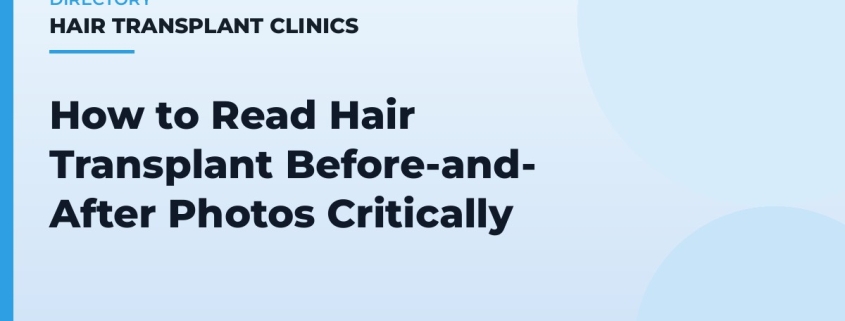 How to Read Hair Transplant Before-and-After Photos Critically