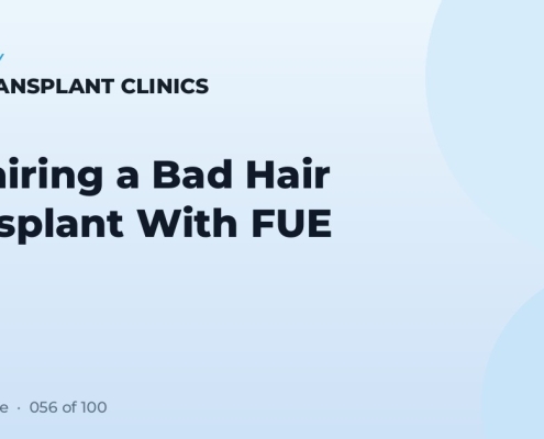 Repairing a Bad Hair Transplant With FUE