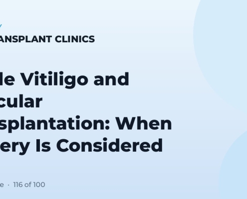 Stable Vitiligo and Follicular Transplantation: When Surgery Is Considered
