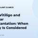 Stable Vitiligo and Follicular Transplantation: When Surgery Is Considered