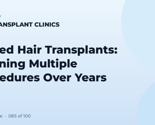 Staged Hair Transplants: Planning Multiple Procedures Over Years