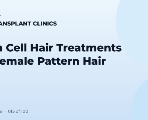 Stem Cell Hair Treatments for Female Pattern Hair Loss
