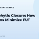 Trichophytic Closure: How Surgeons Minimize FUT Scars