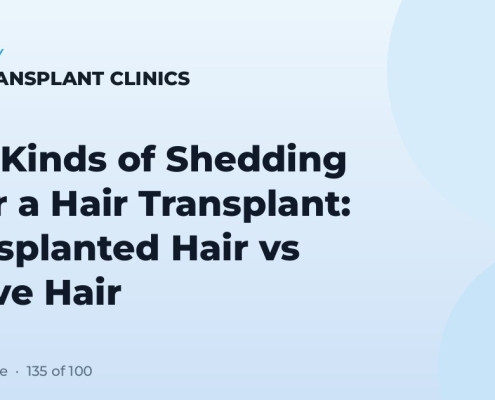 Two Kinds of Shedding After a Hair Transplant: Transplanted Hair vs Native Hair